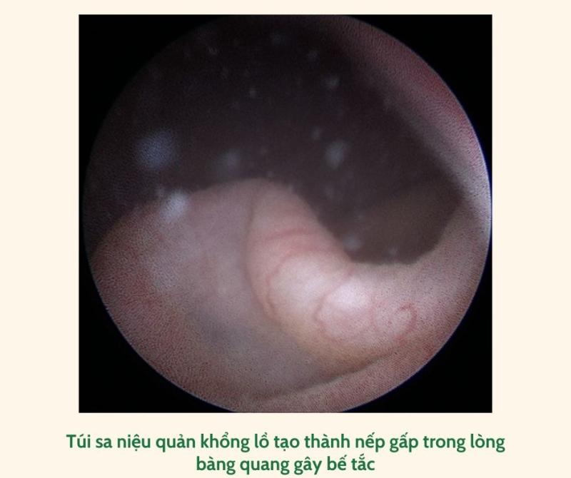 di tat nieu quan anh 1