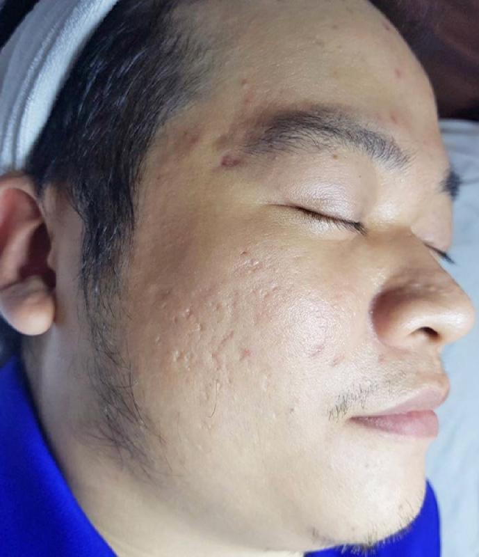 O2 Skin anh 3