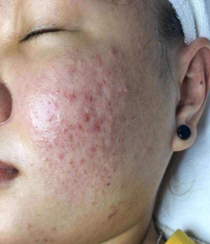 O2 Skin anh 4