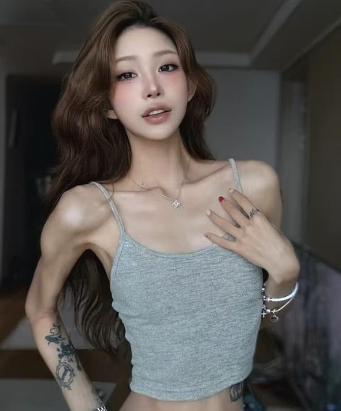 Choi Jun Hee,  giam can,  lupus,  ban do anh 5