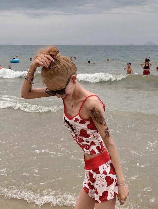 Choi Jun Hee,  giam can,  lupus,  ban do anh 2
